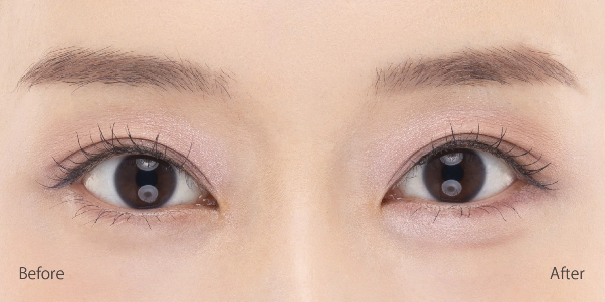 Under Eye Liner Before After