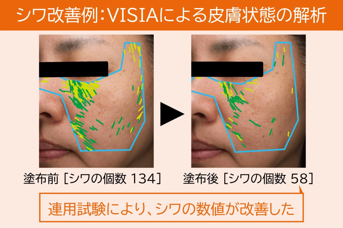 シワ改善例:VISIAによる皮膚状態の解析 塗布前 [シワの個数 134] 塗布後 [シワの個数 58] 連用試験により、シワの数値が改善した