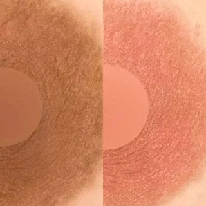 Comparaci&oacute;n de texturas de piel