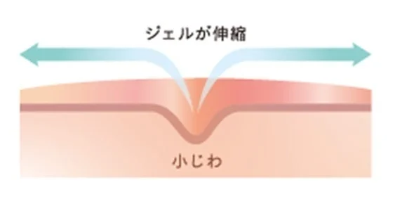 Mecanismo de Gel El&aacute;stico para L&iacute;neas Finas