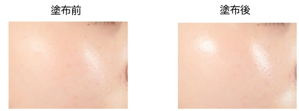 Comparaci&oacute;n antes y despu&eacute;s de la aplicaci&oacute;n