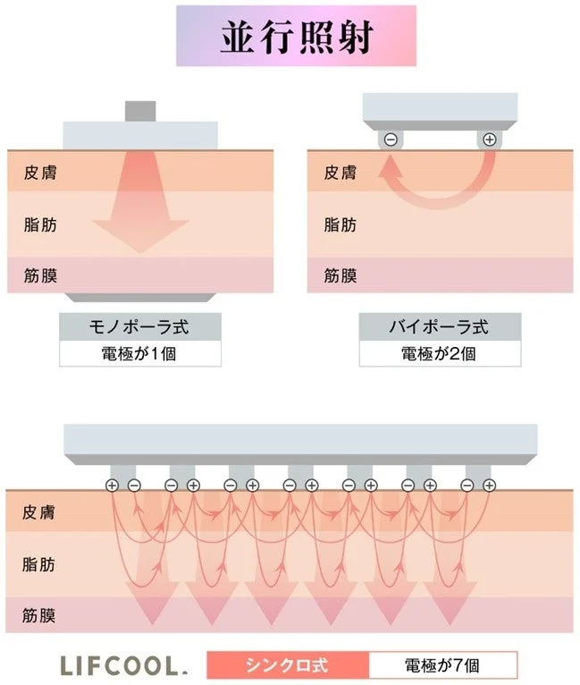 Diagrama de irradiación paralela