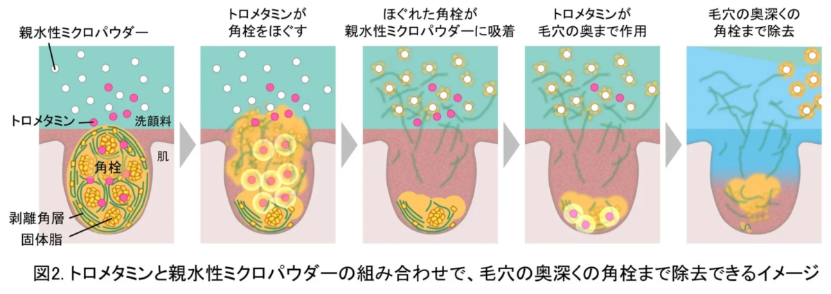 Ilustraci&oacute;n del mecanismo de eliminaci&oacute;n de tapones de sebo