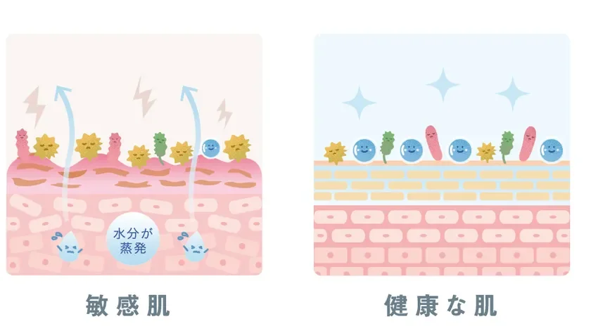 Comparaci&oacute;n de piel sana y piel sensible