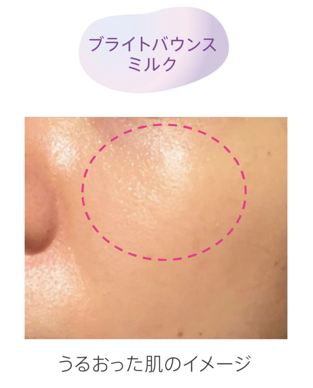 Imagen de piel hidratada