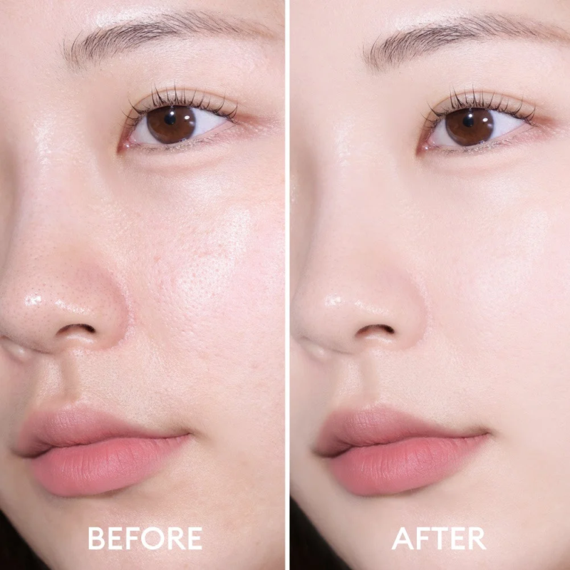 Before After Skin