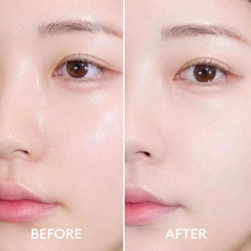 Comparaci&oacute;n de antes y despu&eacute;s del cuidado de poros