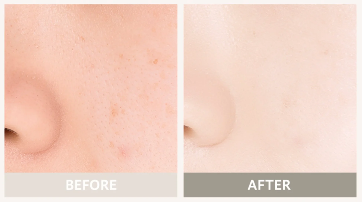 Comparaci&oacute;n antes y despu&eacute;s del uso de prebase