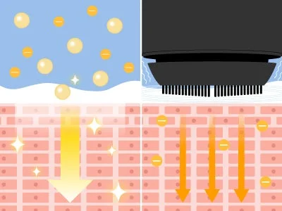 Ilustraci&oacute;n de importaci&oacute;n i&oacute;nica