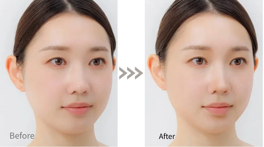 Comparaci&oacute;n antes y despu&eacute;s del contorno