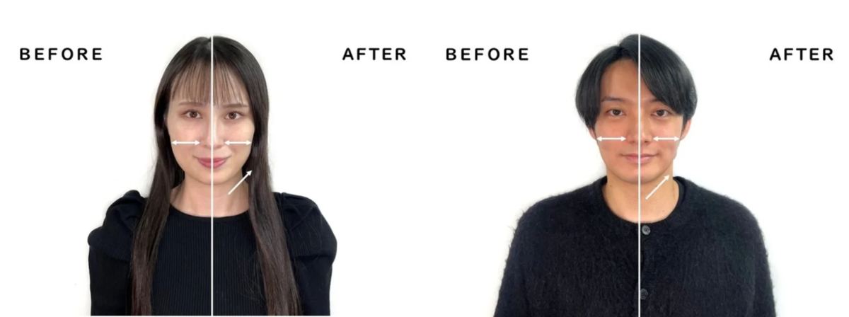 Antes y Después del rostro