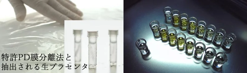 Investigación sobre la extracción de placenta cruda