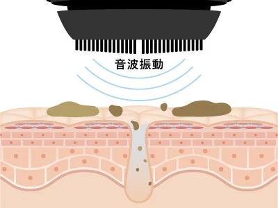 Ilustraci&oacute;n de vibraci&oacute;n s&oacute;nica