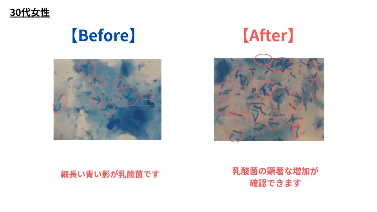 Resultados Mujer B (30s) - Antes y Despu&eacute;s