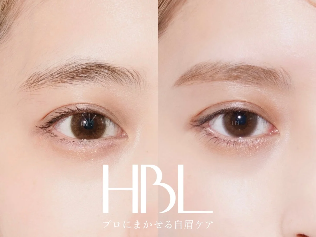 Comparaci&oacute;n del antes y el despu&eacute;s de las cejas con HBL