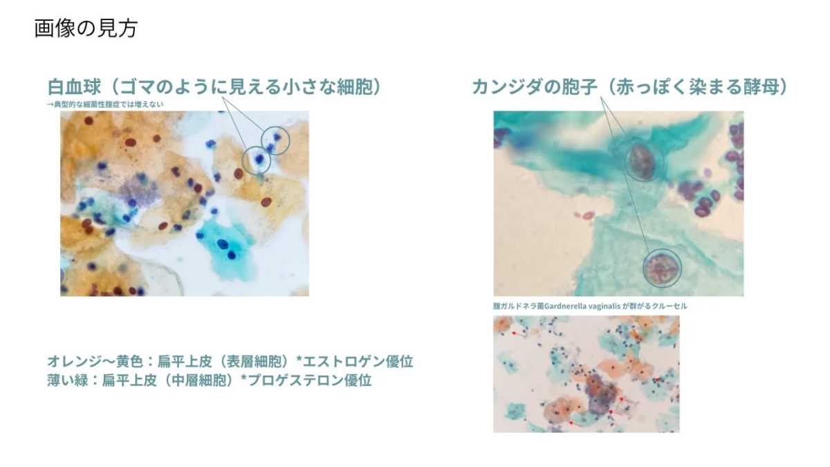 Gu&iacute;a para interpretar im&aacute;genes microsc&oacute;picas 1