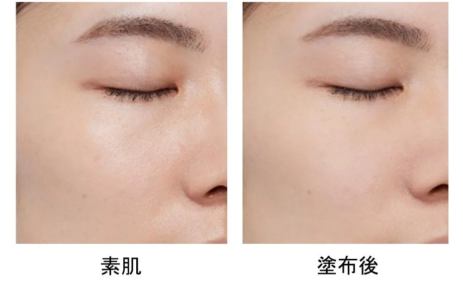 Imagen de Antes y Después