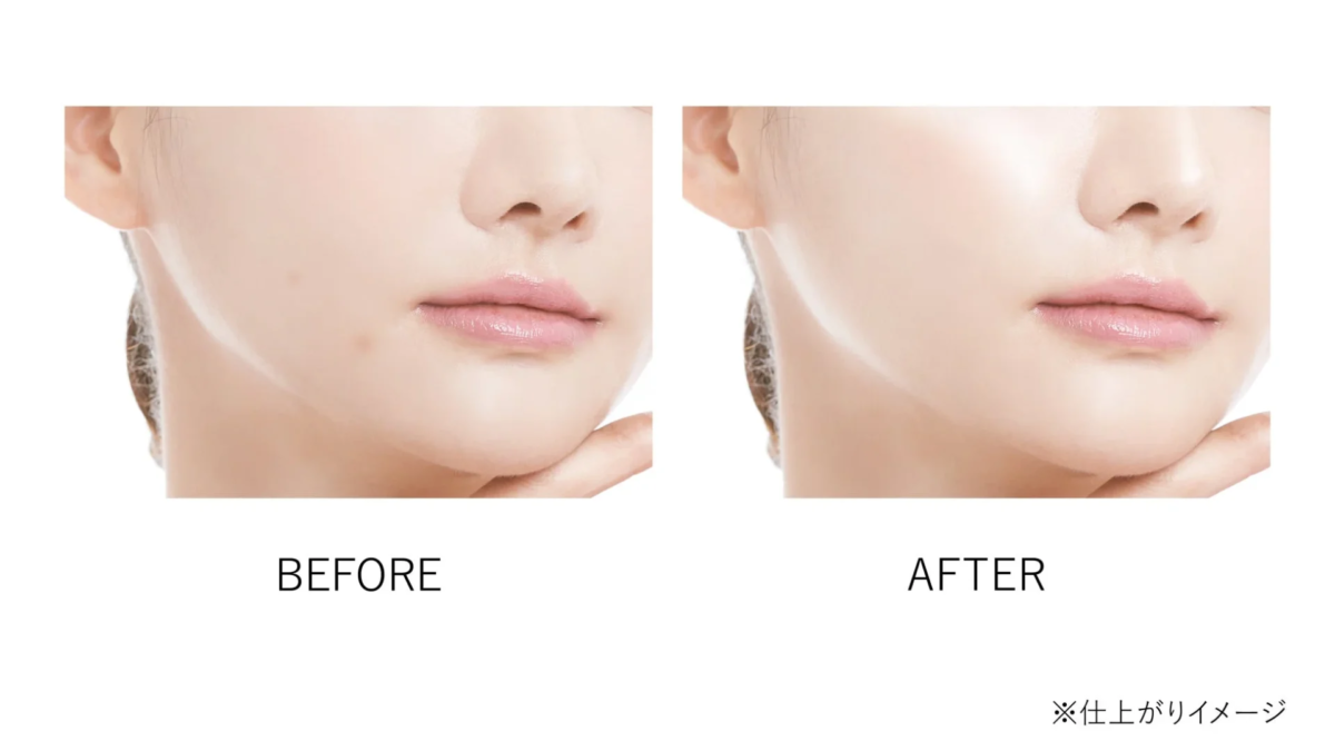 Comparaci&oacute;n antes y despu&eacute;s