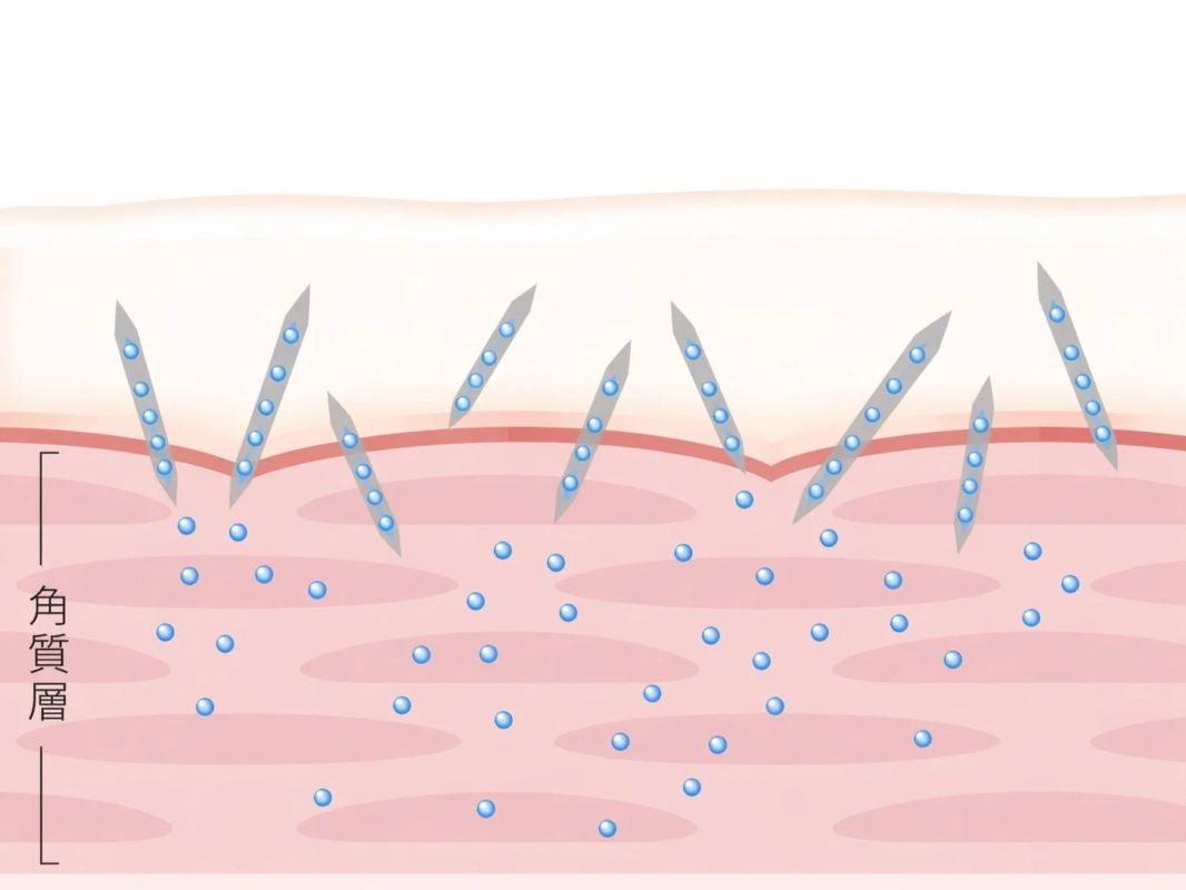 Esquema de penetraci&oacute;n de microagujas en el estrato c&oacute;rneo