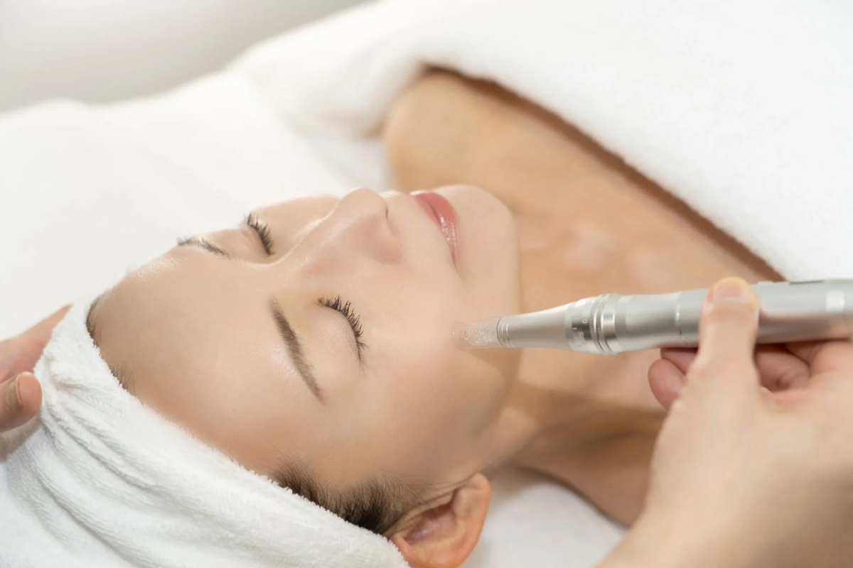 Soft Dermapen versi&oacute;n est&eacute;tica