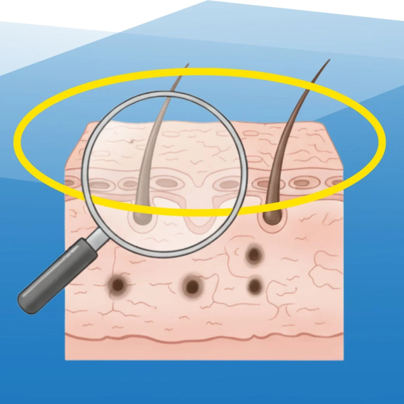 Cuidado de Poros y Manchas Oscuras