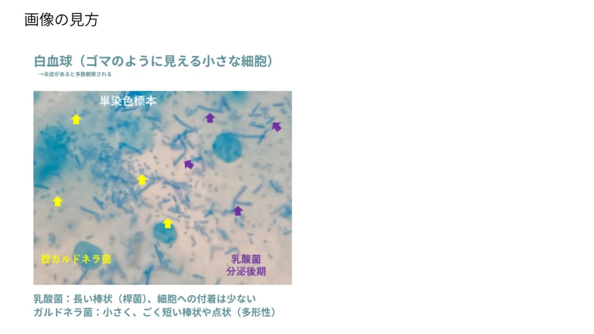 Gu&iacute;a para interpretar im&aacute;genes microsc&oacute;picas 2