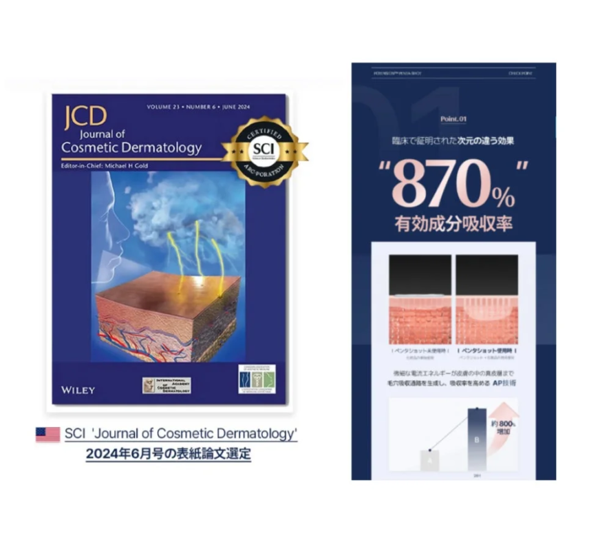 Explicaci&oacute;n de la tecnolog&iacute;a AP