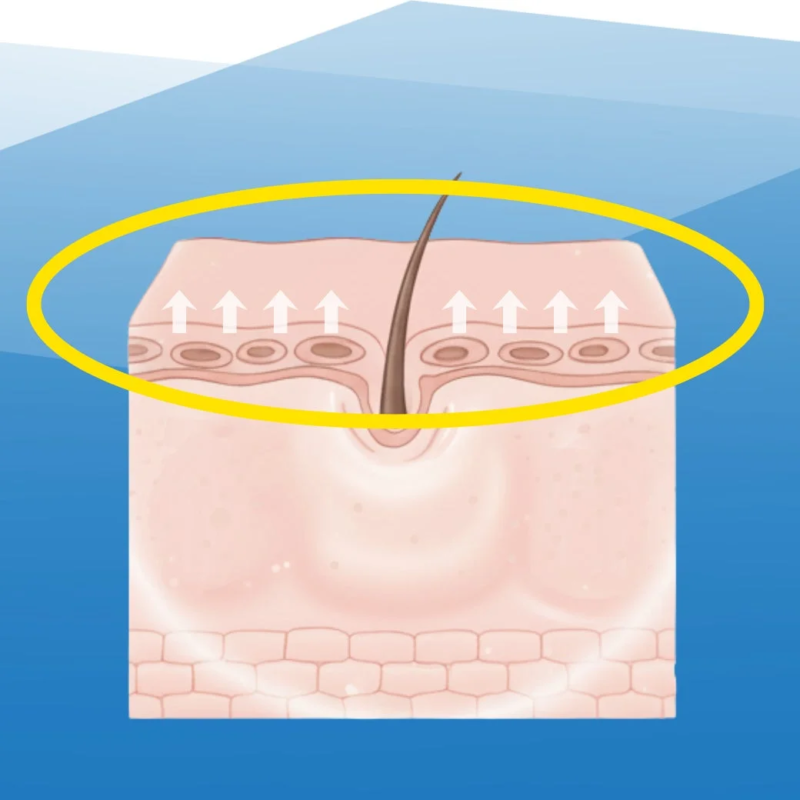 Ilustraci&oacute;n de cuidado para la firmeza