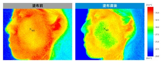 Comparación de temperatura de la piel antes y después de la aplicación