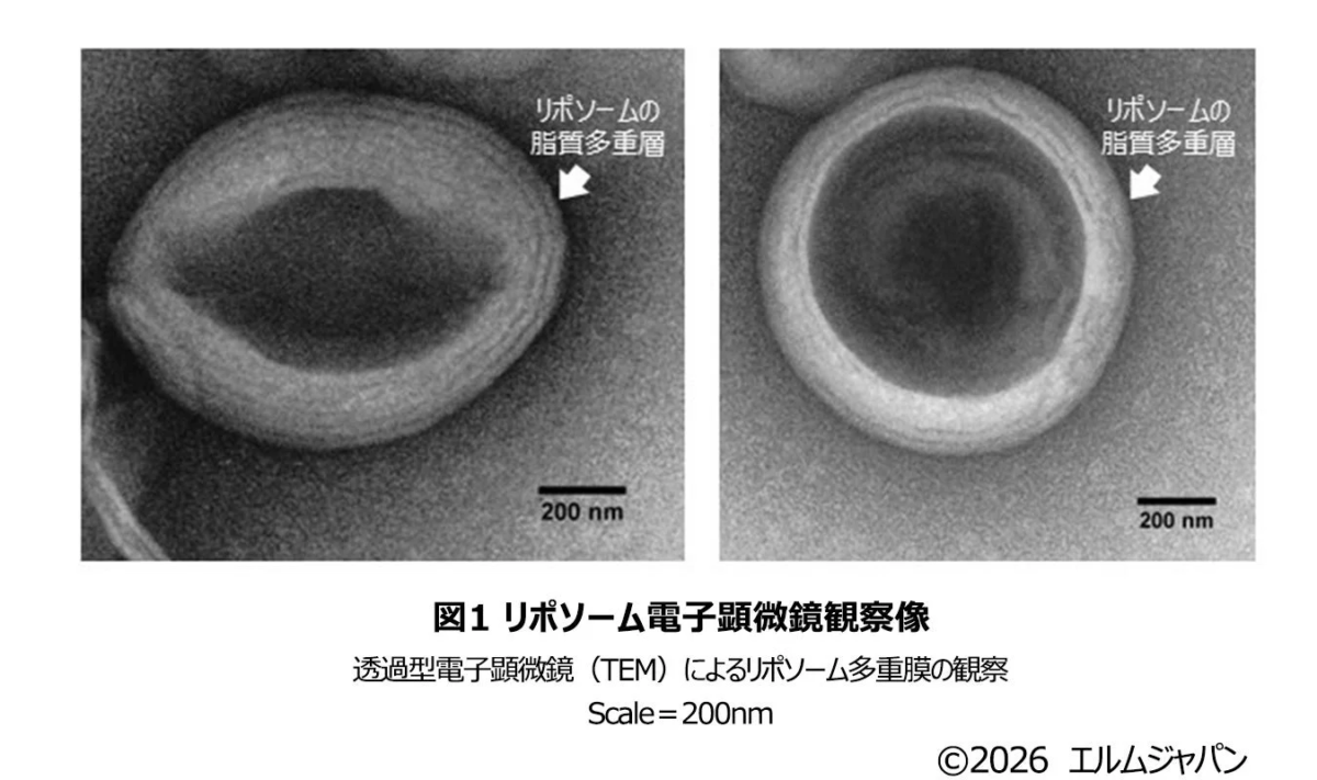 Liposomas multilamelares observados con microscopio electrónico de transmisión (TEM)