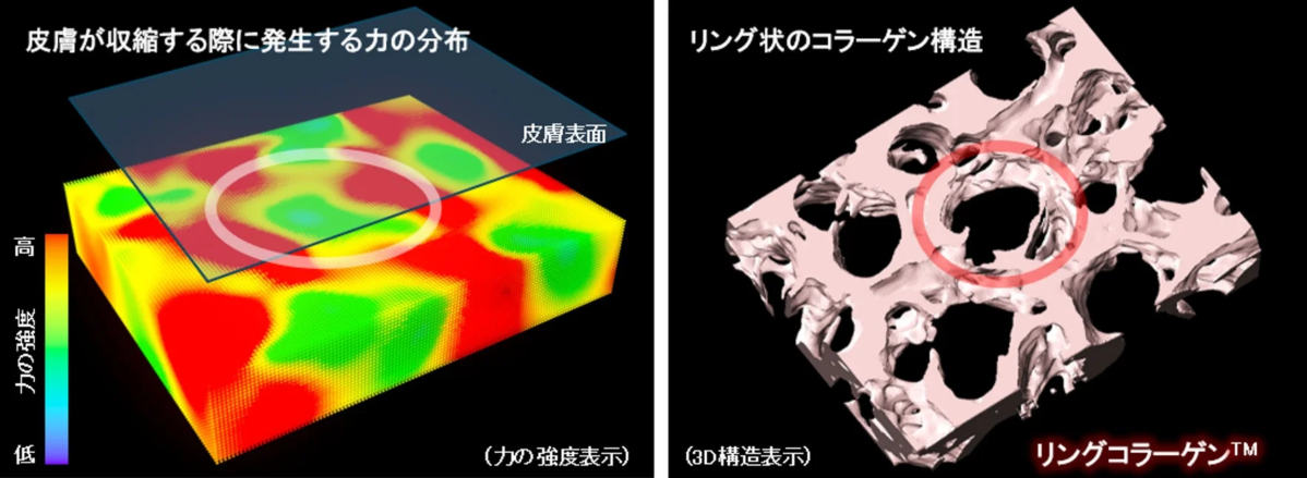Distribución de la Fuerza y Estructura del Colágeno Anular™