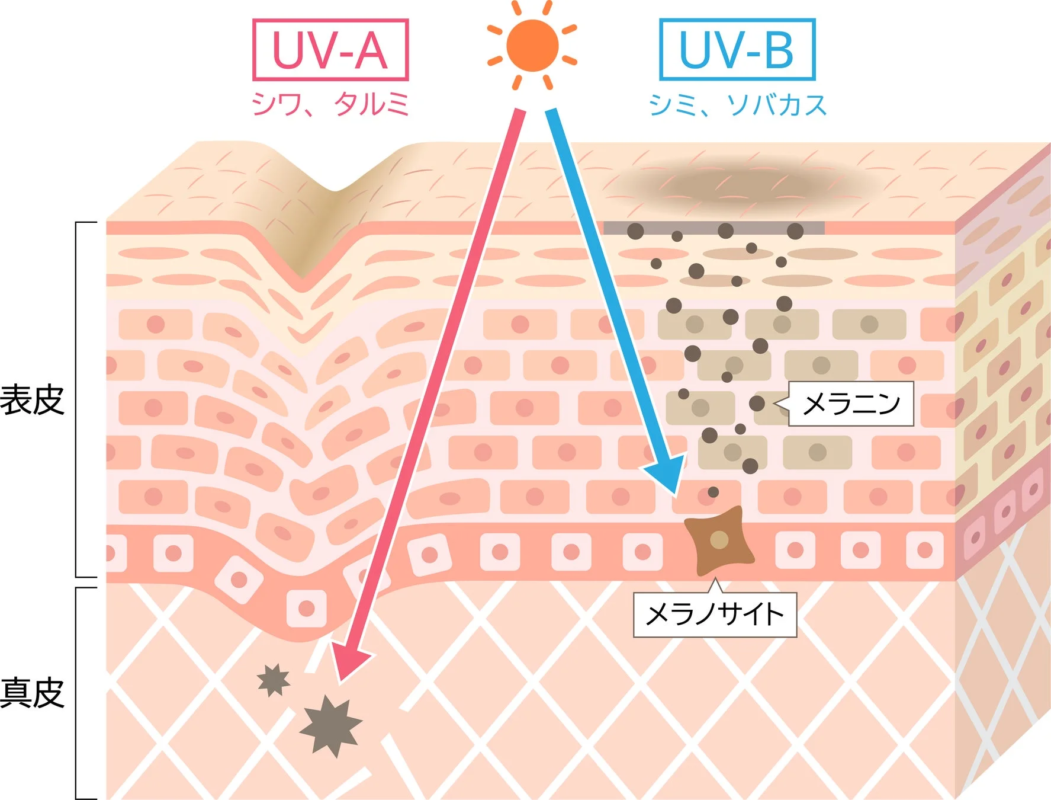Impacto de los rayos UV en la piel